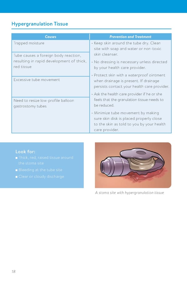 Guide to Adult Tube Feeding at Home  - Page 20