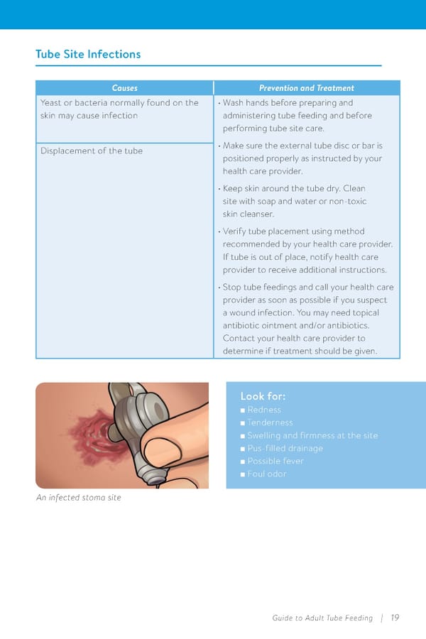 Guide to Adult Tube Feeding at Home  - Page 21