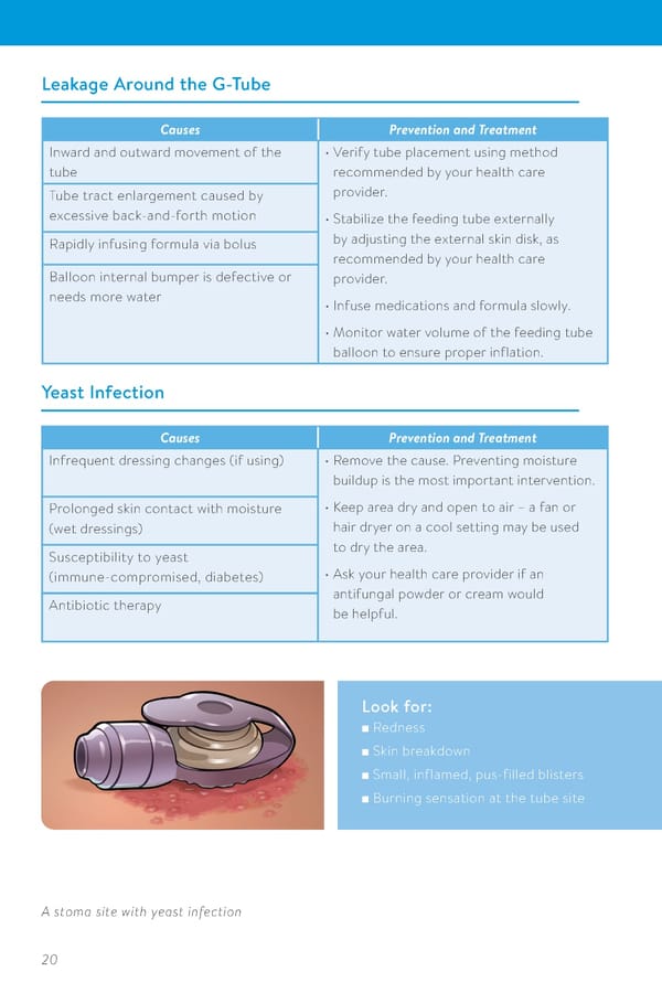 Guide to Adult Tube Feeding at Home  - Page 22